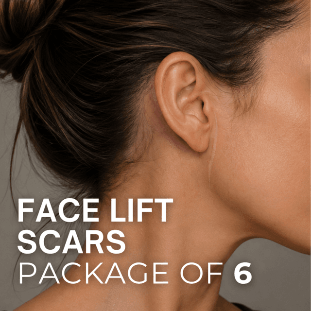Face Lift Scars (Package of 6) at TRUE HUE AESTHETICS in Beverly Hills, CA