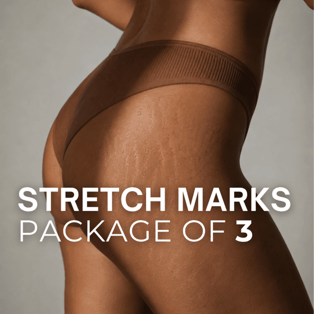 Stretch Marks (Package of 3) at TRUE HUE AESTHETICS in Beverly Hills, CA