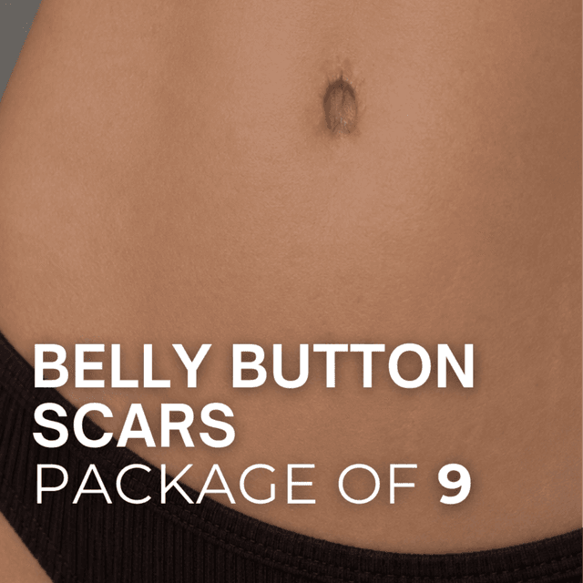 Bely Button Scars (Package of 9) at TRUE HUE AESTHETICS in Beverly Hills, CA