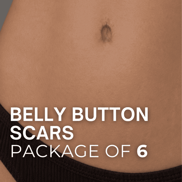 Belly Button Scars (Package of 6) at TRUE HUE AESTHETICS in Beverly Hills, CA