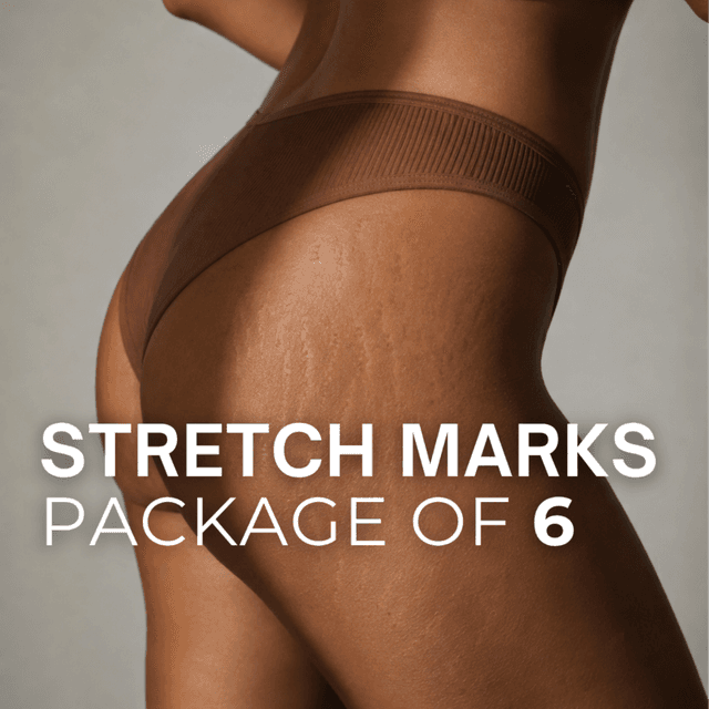 Stretch Marks (Package of 6) at TRUE HUE AESTHETICS in Beverly Hills, CA