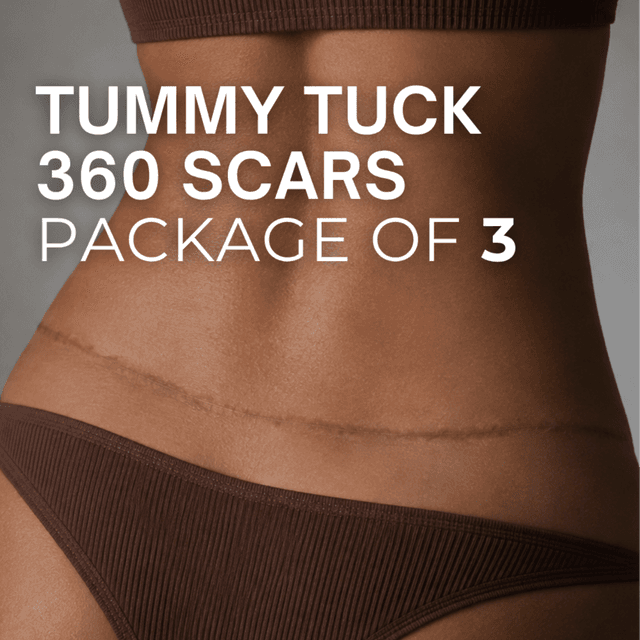 360 Tummy Tuck Scars (Package of 3) at TRUE HUE AESTHETICS in Beverly Hills, CA